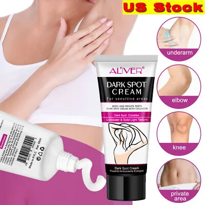 $9.35 • Buy Full Body Dark Skin Whitening Cream Armpit Knee Bleaching Lightening Brightening
