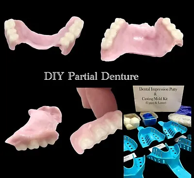 DIY Partial Denture Kit Putty Dental Impression At Home Denture Making A1/23 • $84.99