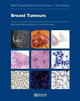 Breast Tumours: WHO Classification Of Tumours (Medicine) • $89.99