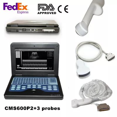 CMS600P2 Portable Ultrasound Scanner Machine Convex+Linear+Transvaginal 3 Probes • $2049