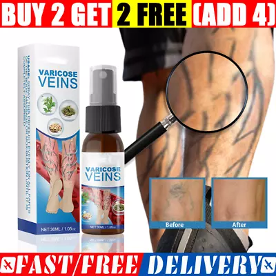 Veinhealing Varicose Veins Treatment Spray For Legs Improve Blood Circulation • $7.99